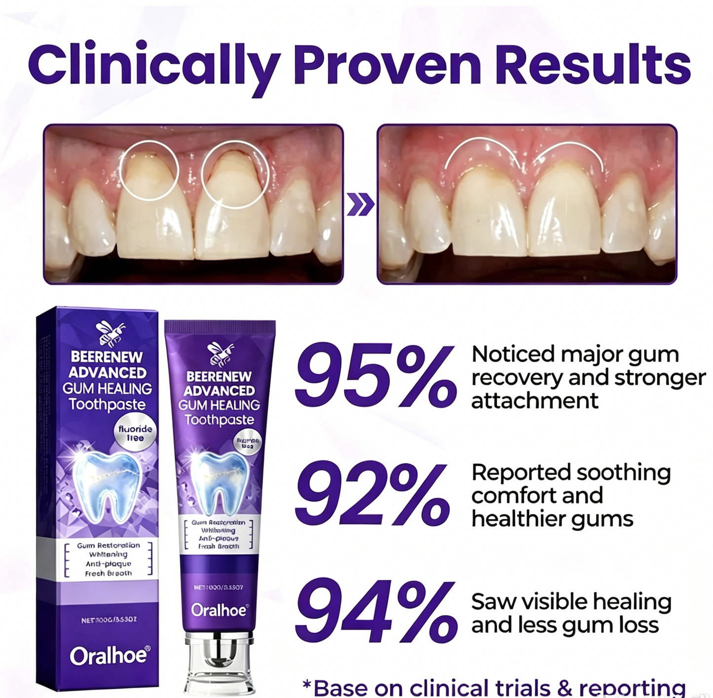 Oralhoe Bee Venom Gum Care Toothpaste