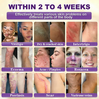 Biotin 10-in-1 Skin Restoration Cream🍀