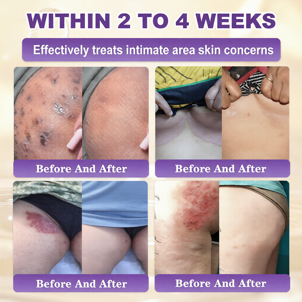 Biotin 10-in-1 Skin Restoration Cream🍀
